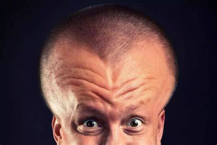 Big Head