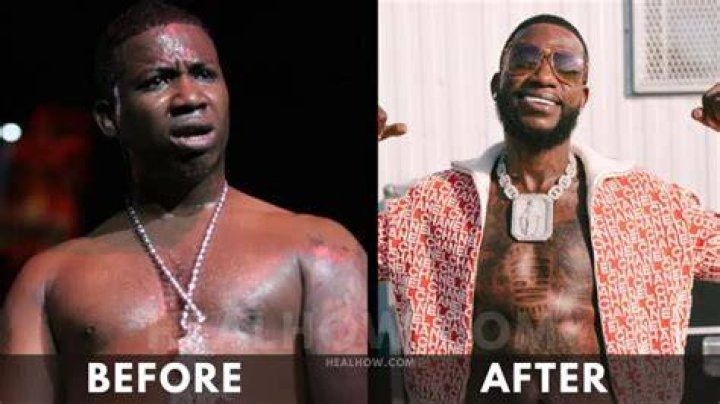 Gucci Mane before and after